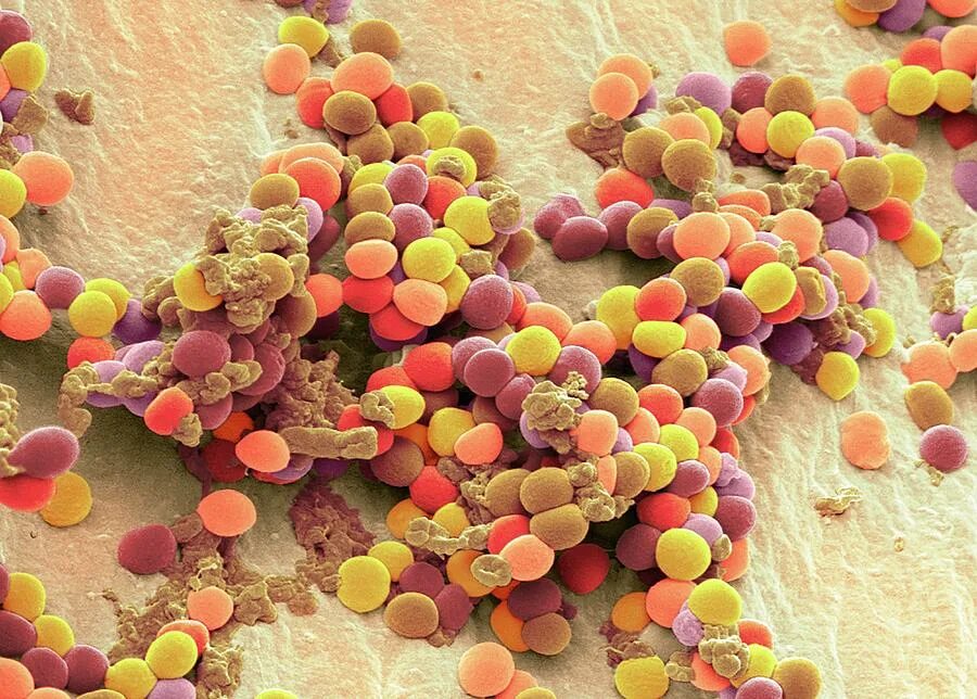 2 staphylococcus aureus