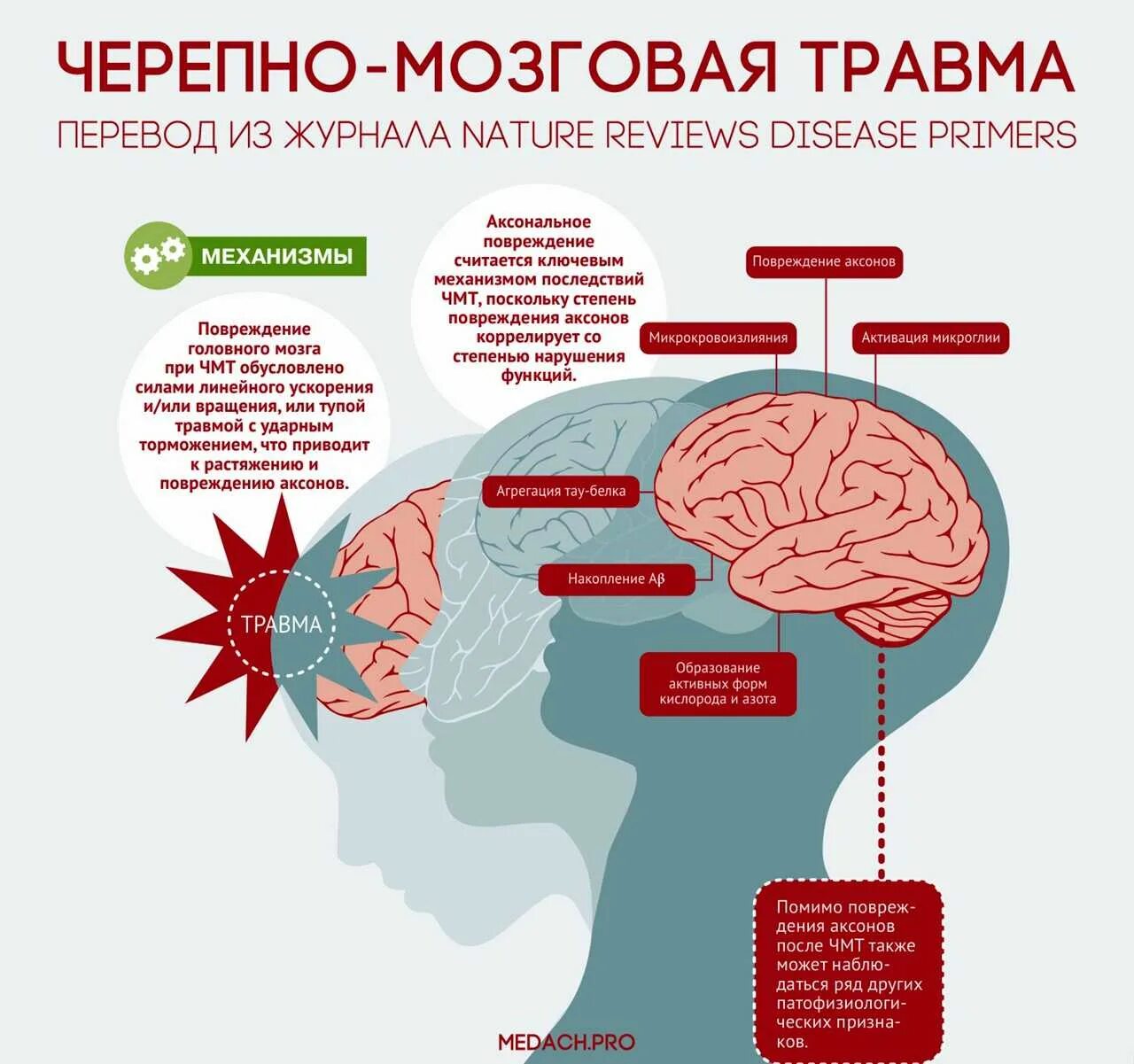 Чмт у детей
