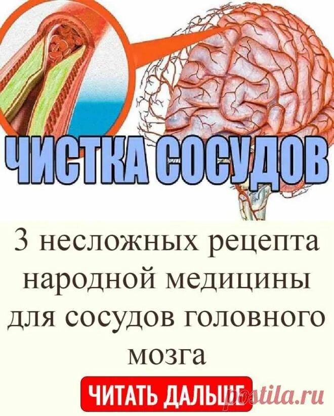 Очищение сосудов головного мозга. Препараты для очистки сосудов и капилляров головного мозга. Средство для очищения сосудов головного мозга. Расширение сосудов головы