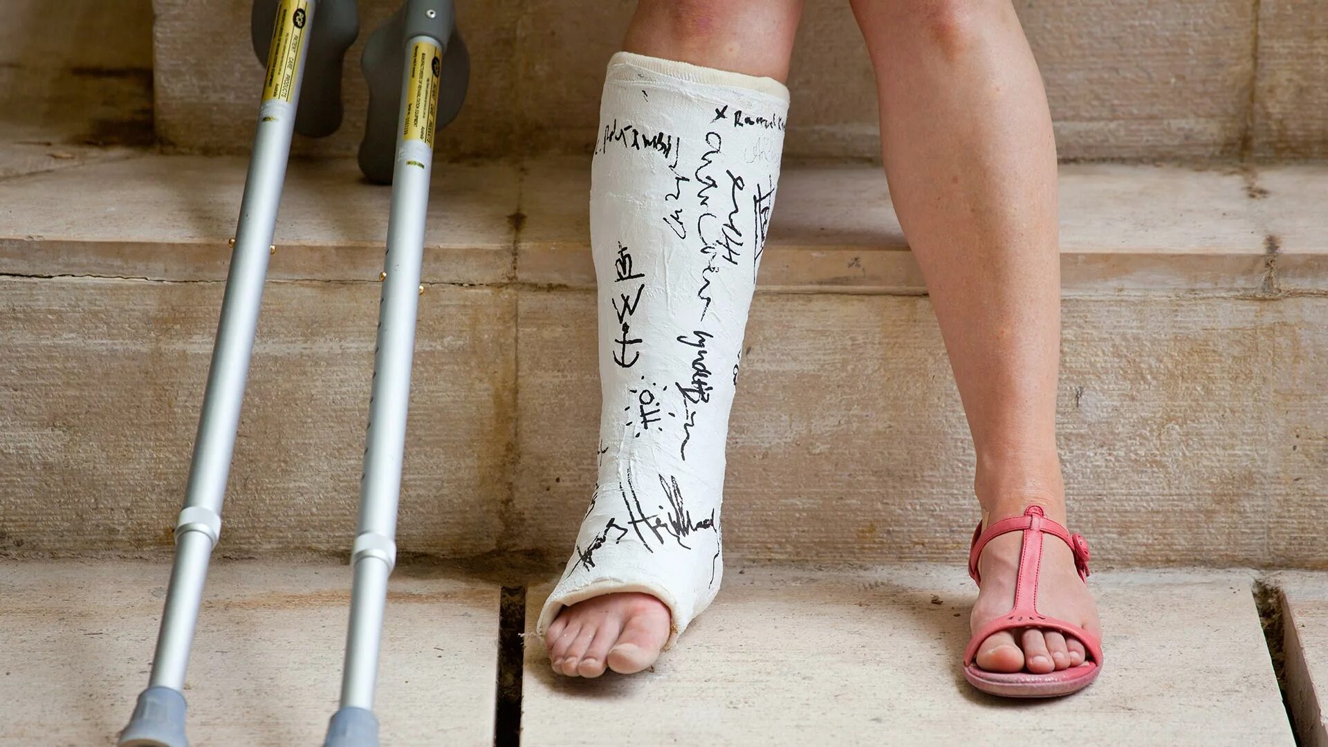 Сломал ноги битой. Сломал ноги битой. Сломал ноги битой. Кевин уэйр баскетболист. Вывих сустава голеностопа.