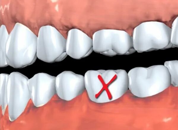 Two tooths. Зуб гиф. Анимированный зуб.