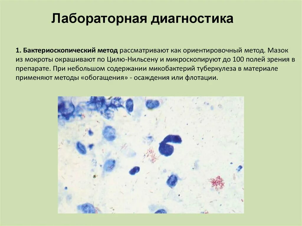 Обследование легких мокроты. Бактериоскопия мокроты по Цилю Нильсену. Микроскопия мокроты по Цилю-Нильсену. Бактериоскопический метод исследования мокроты. Мазок из мокроты по Цилю Нильсену.