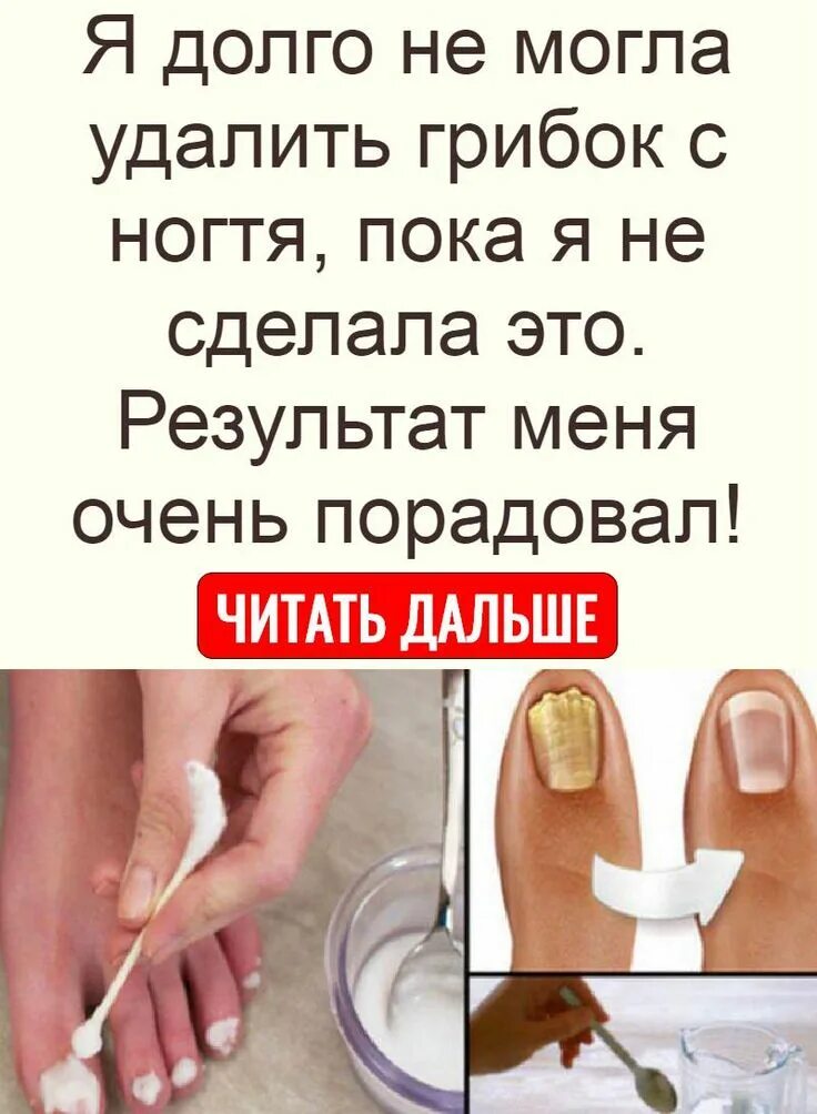 Эффективные способы избавления от грибка на ногтях при помощи народных средств С