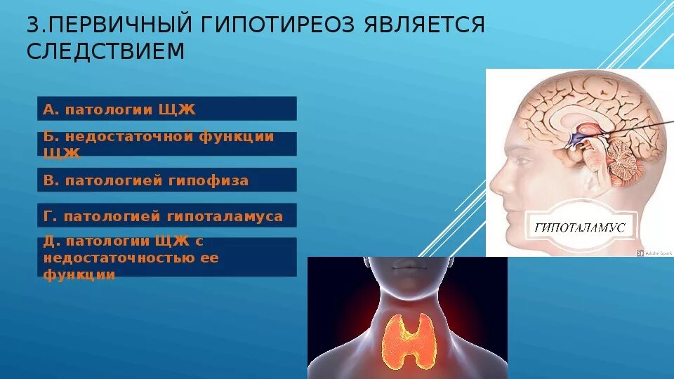 Патогенез первичного гипотиреоза. Первичный гипотиреоз этиология. Патологии гипоталамуса гипотиреоз.