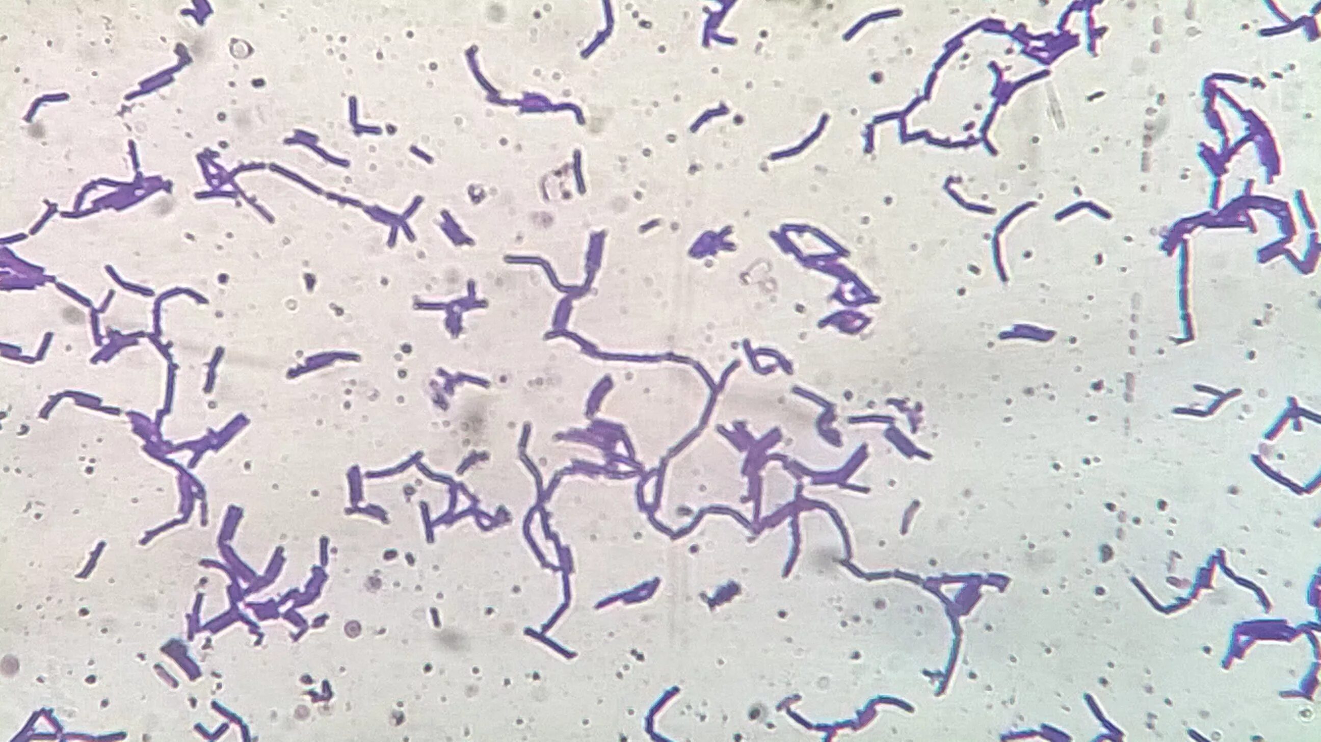 Палочка бифидобактерии. Lactobacillus Acidophilus в микроскопе. Лактобациллы палочки Дедерлейна. Молочнокислые бактерии лактобациллы. Ацидофильные лактобактерии (Lactobacillus Acidophilus).
