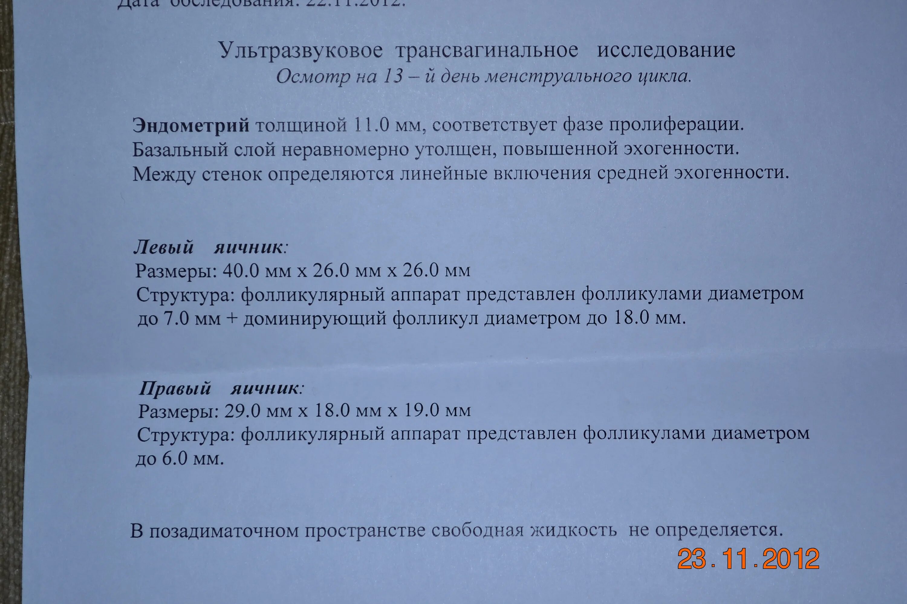 Гистология после замершей беременности. Что показывает гистология после замершей беременности. Справка о замершей беременности. Расшифровка гистологии после выскабливания замершей беременности. Через сколько после замершей беременности можно забеременеть