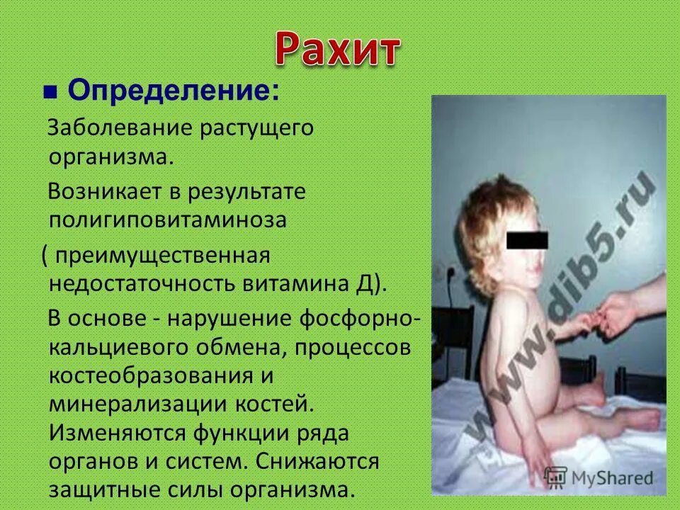 Болезнь рос. Болезнь рос