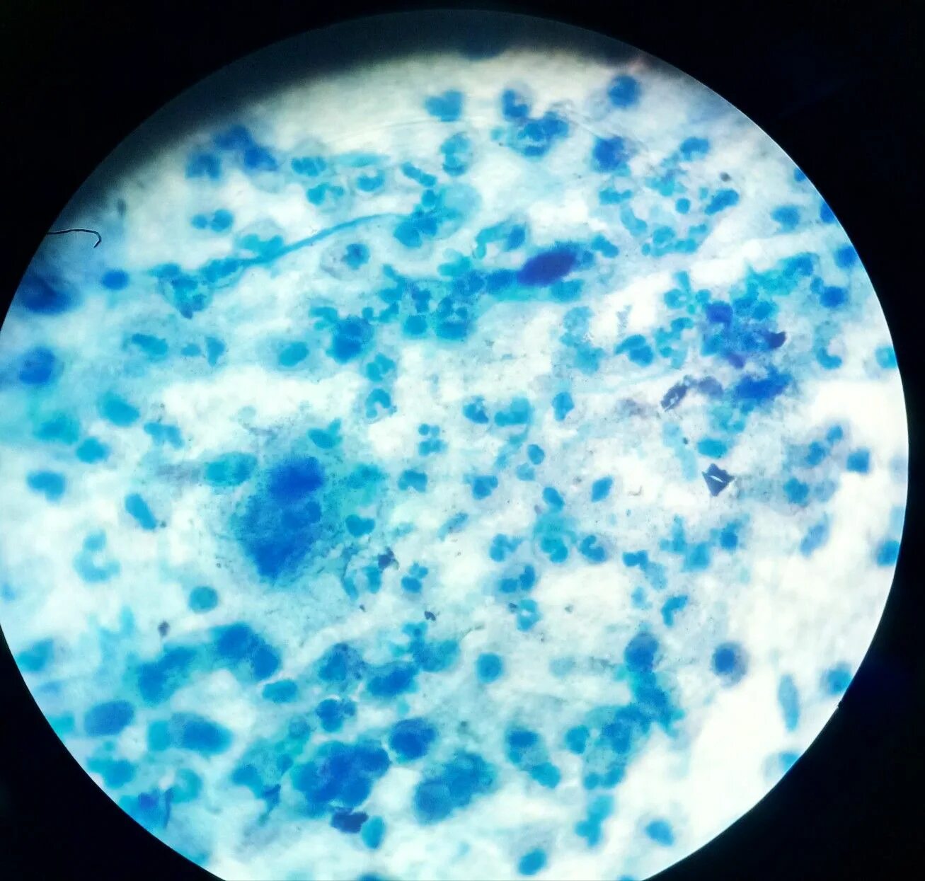 Иерсинии метиленовый синий. Хромоскопия метиленовый синий. Метиленовый синий Леффлера. Acetobacter метиленовый синий. Иммунолиз
