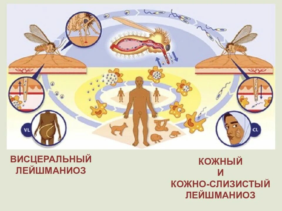 Висцеральный лейшманиоз. Медицинская протозоология. кожный и висцеральный лейшманиоз. профилактика кожного лейшманиоза. тема медицинская протозоология.