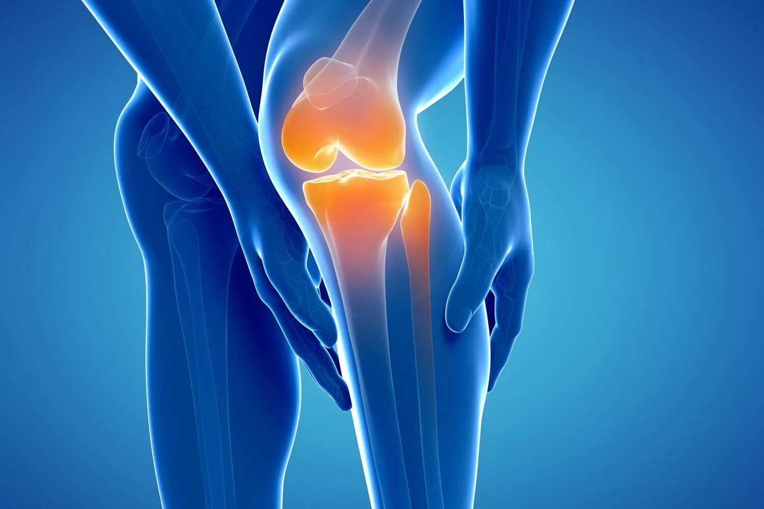 Остеоартрит коленного сустава. Супрапателлярный импиджмент коленного сустава. Остеоартрит (артроз, дегенеративные заболевания суставов). Хондропатия коленного сустава. Артропатия лечение