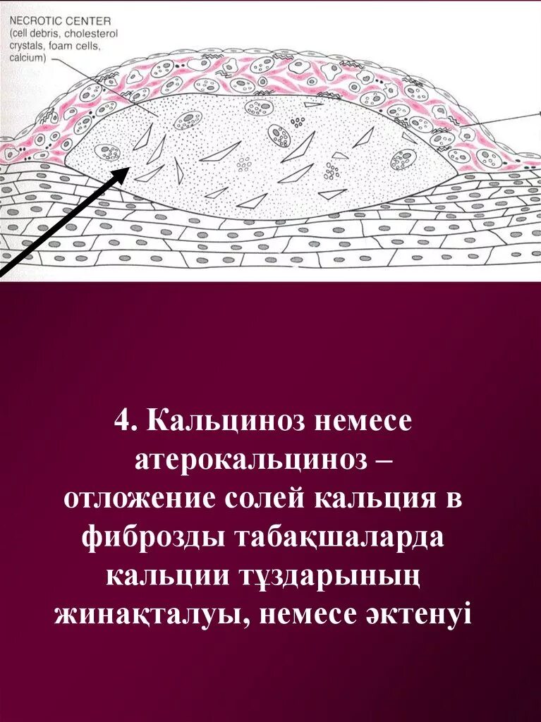 Кальциевые образования