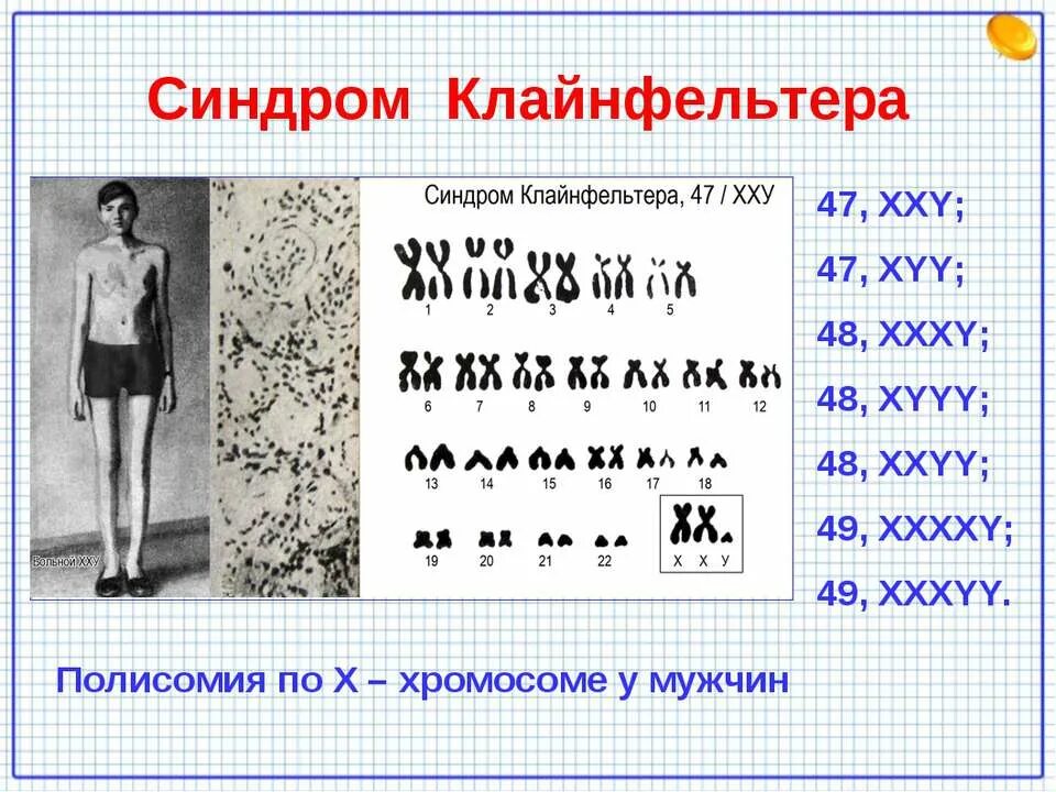 Синдром Клайнфельтера 47 xxy. Полисомия кариотип. 48 Хромосом у человека синдром Клайнфельтера.