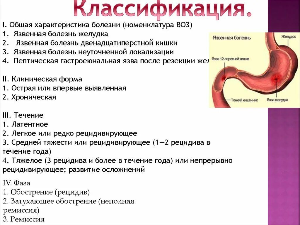 Стеноз кишечника что это. Язвенная болезнь желудка локализация язвы. Основные симптомы язвенной болезни желудка и 12-перстной кишки. Язвенная болезнь желудка классификация по течению. Основная причина развития язвенной болезни двенадцатиперстной кишки.