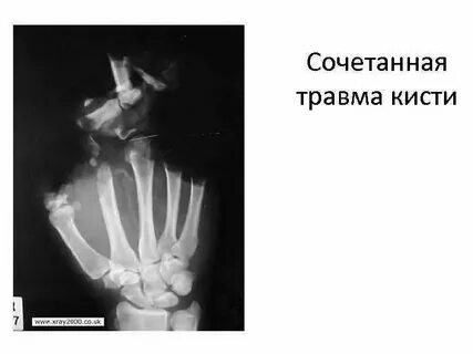 Сочетанные множественные и комбинированные