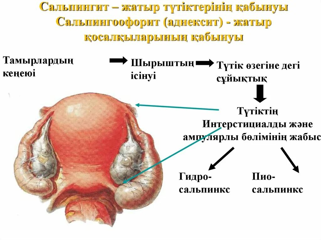 Жатыр деген не. Жыныс мучоого кийгизилуучу шакектер. Онкологиялы? аурулар презентация. Жатыр деген не. Жатыр деген не.