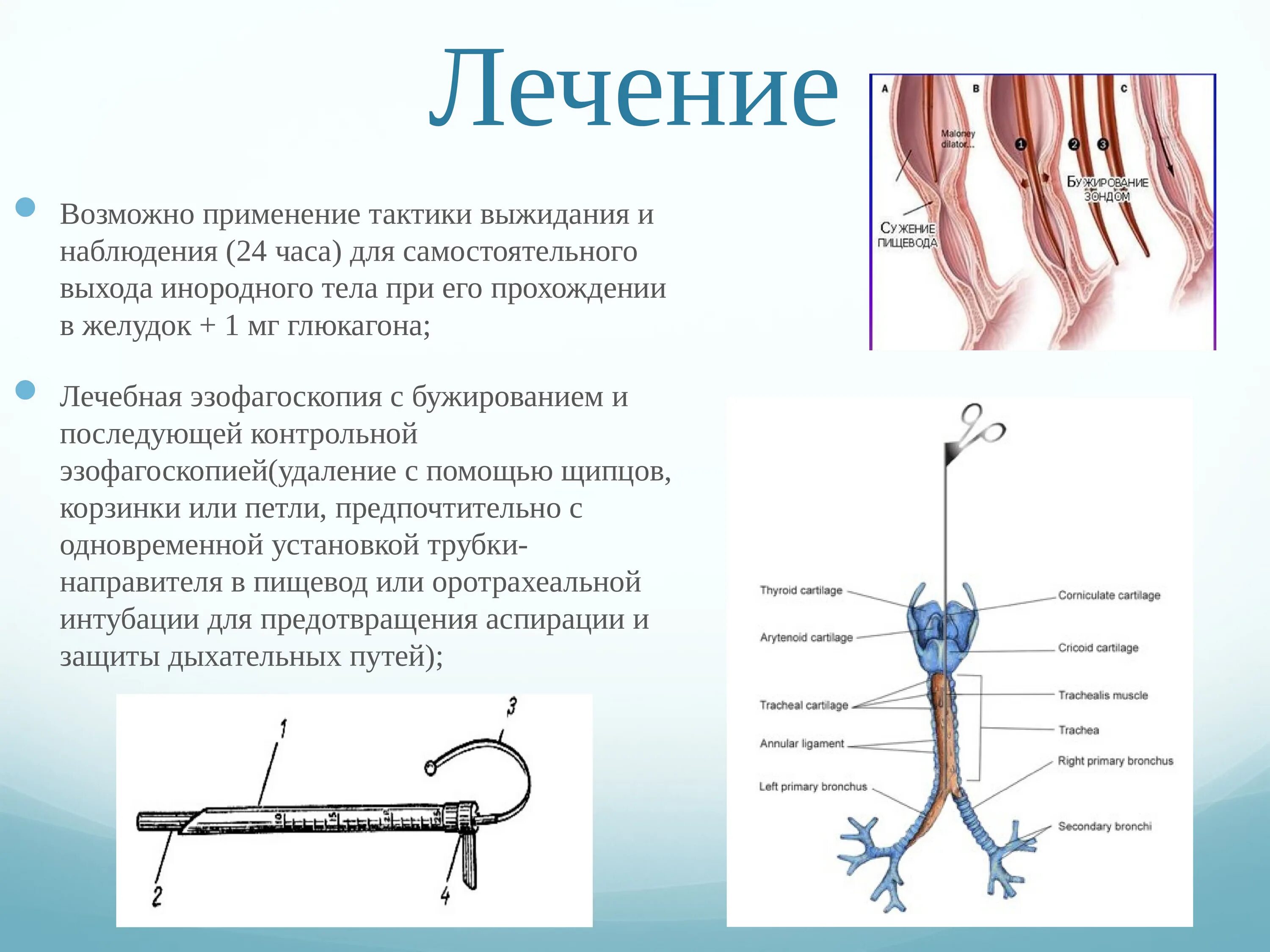 Тело пищевода. Инородные тела пищевода презентация. Инородные тела дыхательных путей и пищевода. Удаление инородных тел эзофагоскопия. Протокол удаления инородного тела в пищеводе.