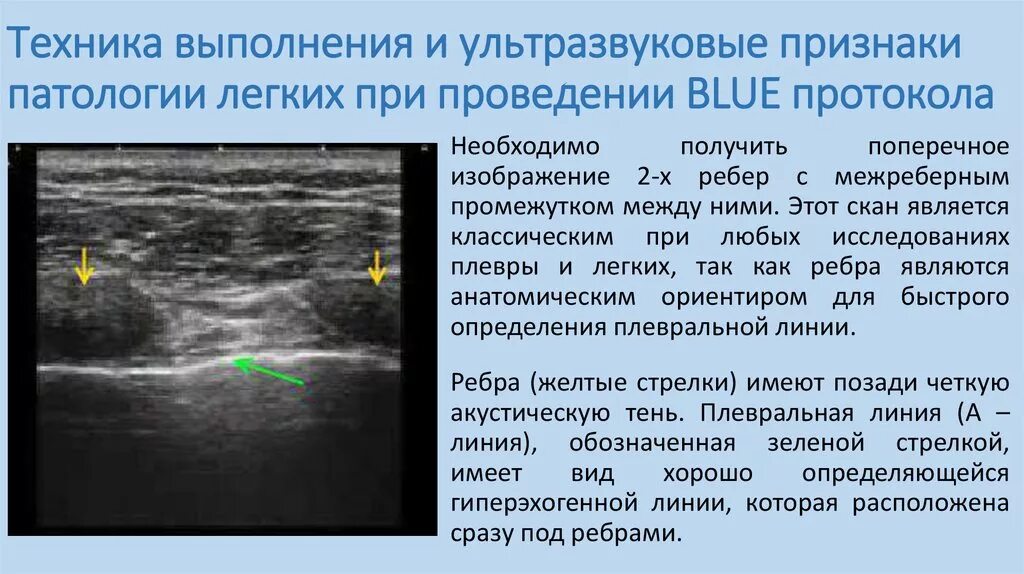 Водно сифонная проба желудка. УЗИ плевральной полости протокол УЗИ. Ультразвуковое исследование плевральных полостей норма. УЗИ плевральных полостей протокол описание. Водно-сифонная проба УЗИ.