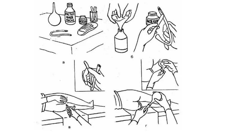 Человеку ставят клизму. Масляная послабляющая клизма. Постановка клизмы картинки. Масляная клизма оснащение. Постановка клизмы детям.