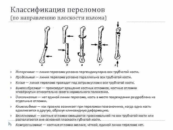 Перелом кости может быть каким. Классификация костных отломков. Классификация переломов по линии излома. Классификация переломов по оси. Классификация переломов хирургия.