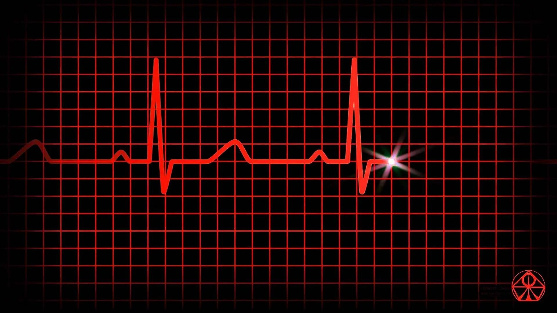 Эффект сердцебиения. Кардиограмма. Кардиограмма сердца. Обои пульс. ЭКГ на черном фоне.