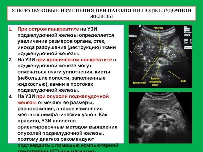 Поджелудочная диффузные реактивные. Паренхима-УЗИ поджелудочной железы. УЗИ поджелудочной железы. Диффузные изменения поджелудочной железы на УЗИ. Изменение поджелудочной железы на УЗИ.