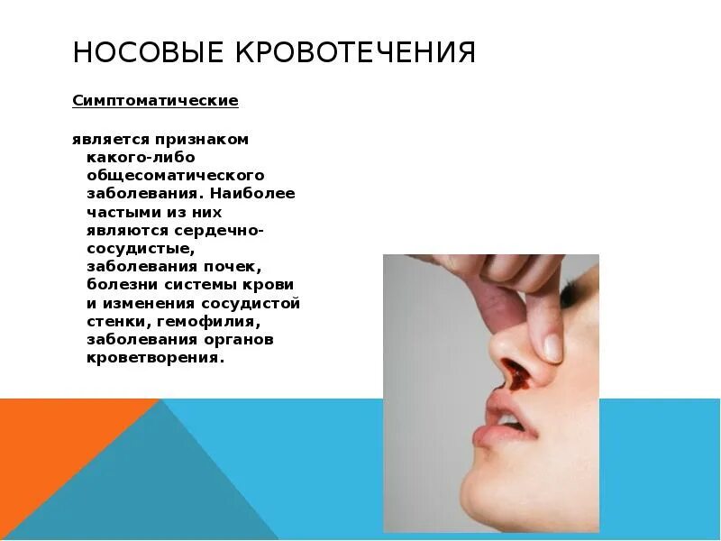 Если носовое кровотечение сопровождается. Симптомы носового кровотечения. Заболевания с носовыми кровотечениями.