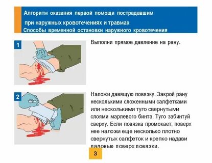 При наружном кровотечении необходимо