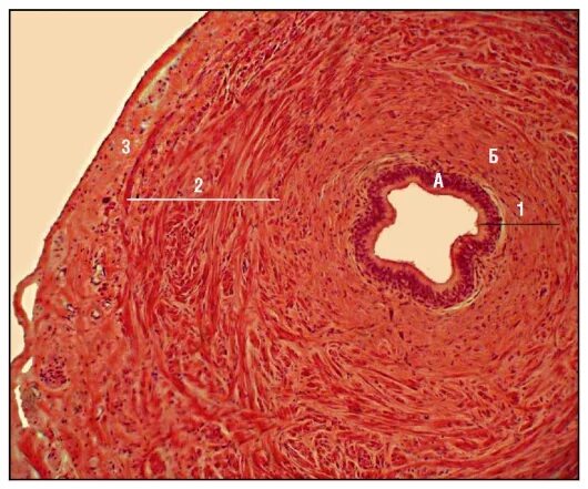 Эякуляторный проток гистология. Окраска гематоксилином и эозином. Семявыносящий проток. Семявыводящий проток гистология. Семя ыфносящий прооток гистология препарат.