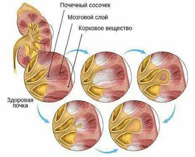 Сосочки почек