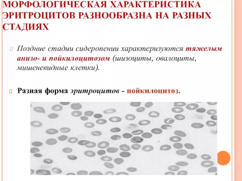 Пойкилоцитоз эритроцитов это. Пойкилоцитоз эритроцитов это