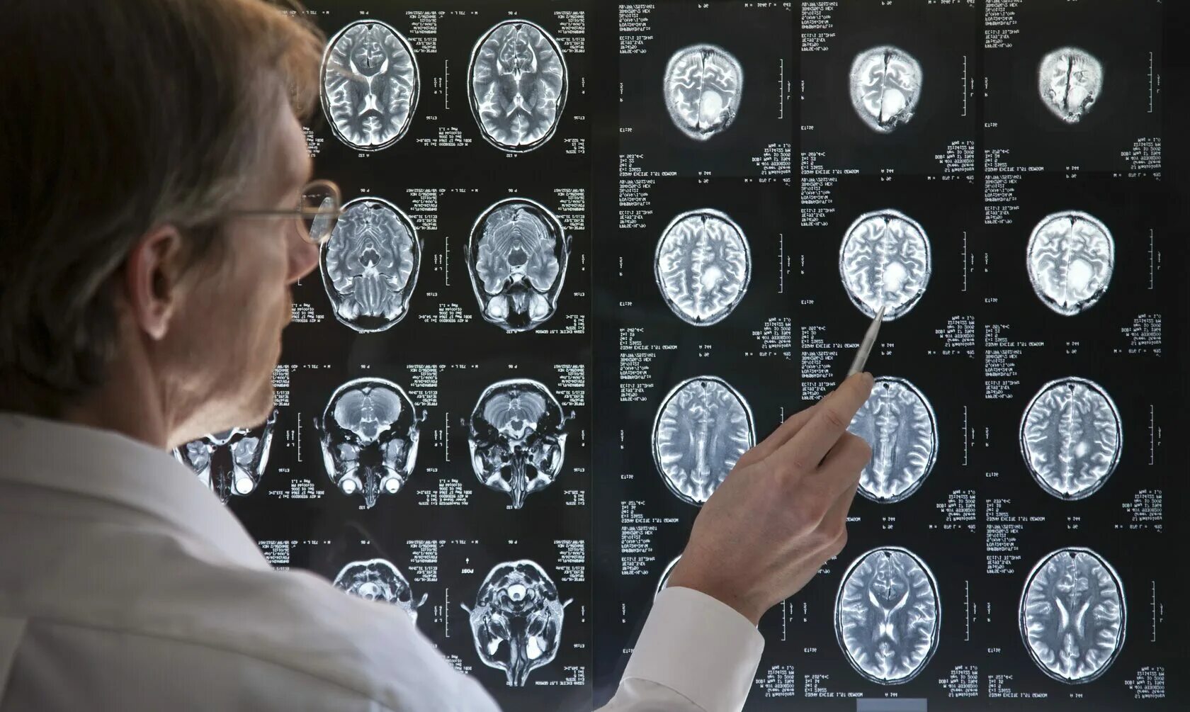 Диагностика головного мозга. Снимок мрт головного мозга. Методы диагностики мозга. Врачи исследование мозга. Лечение рака головного мозга