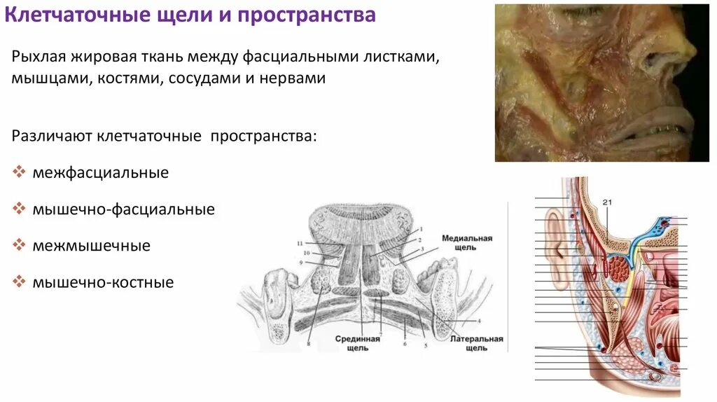 Пространства дна полости рта. Височно-крыловидное клетчаточное пространство. Клетчаточное пространство дна полости рта анатомия. Надкрыловидное клетчаточное пространство. Клетчаточные пространства лица топографическая анатомия.