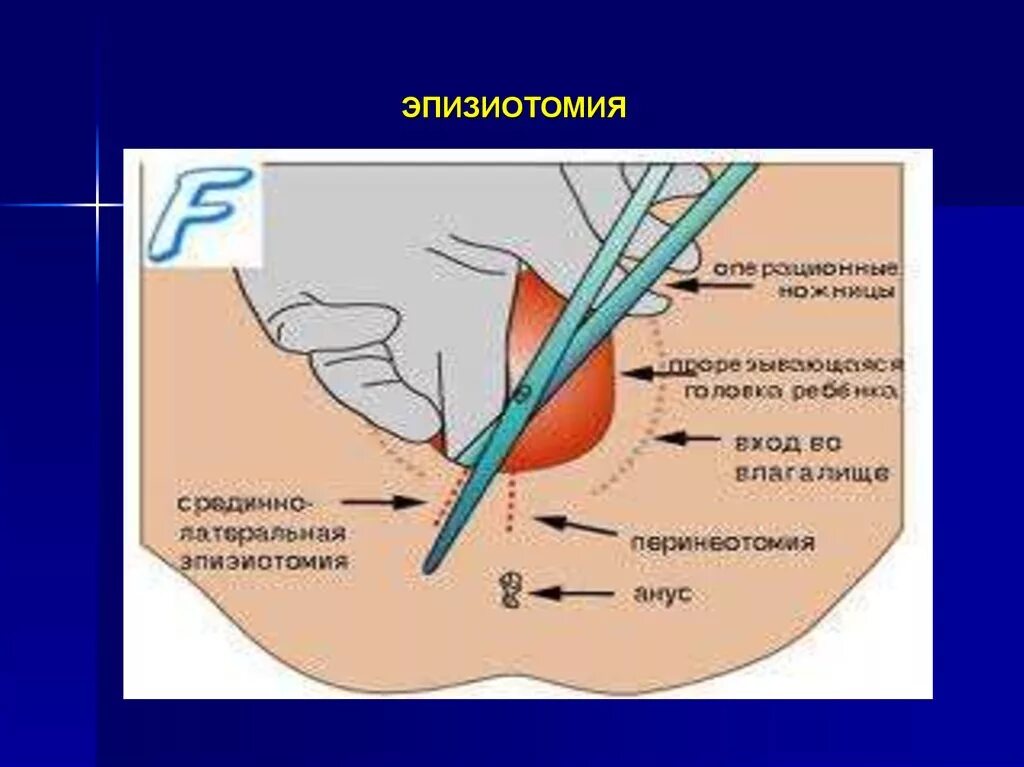 После Родов Во Время Секса