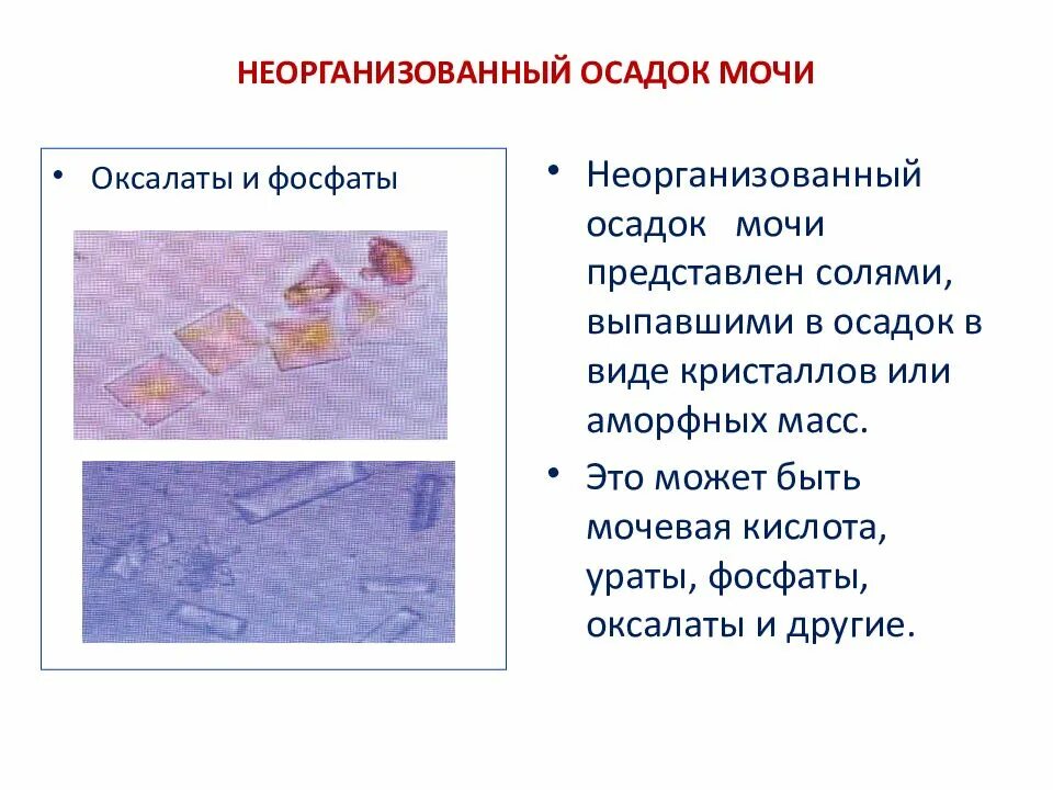 Аморфные фосфаты микроскопия мочи. Организованные и неорганизованные осадки мочи. Неорганизованный осадок мочи. Соли в моче. Высокая соль в моче