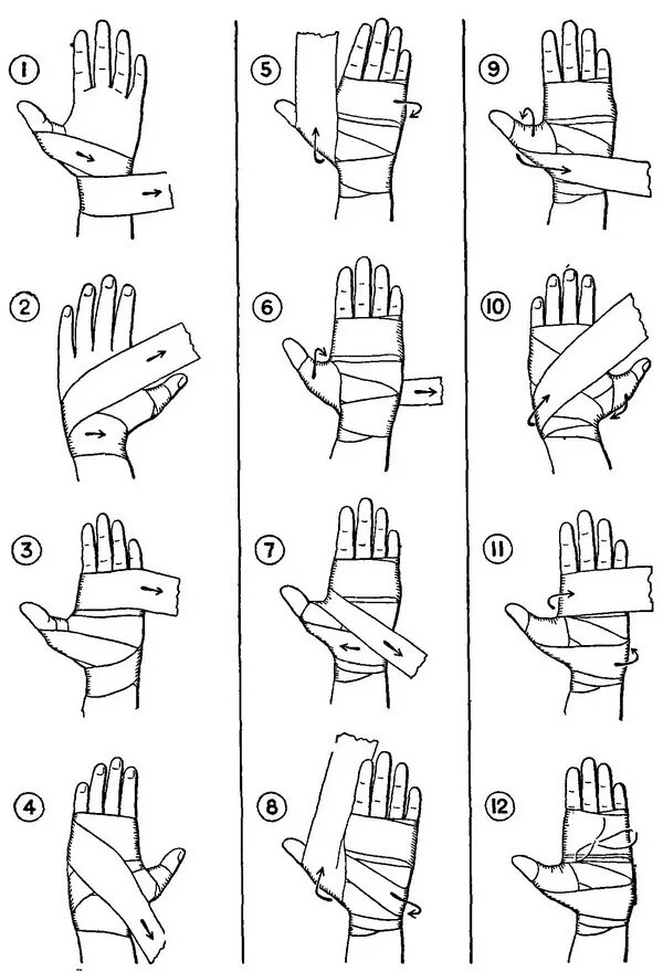 Схема бинтования руки боксерскими бинтами. Схема бинтования руки эластичным бинтом. Схема перевязки кисти. Схема бинтования лучезапястного сустава.