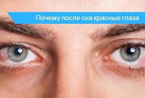 Сон слипшиеся глаза