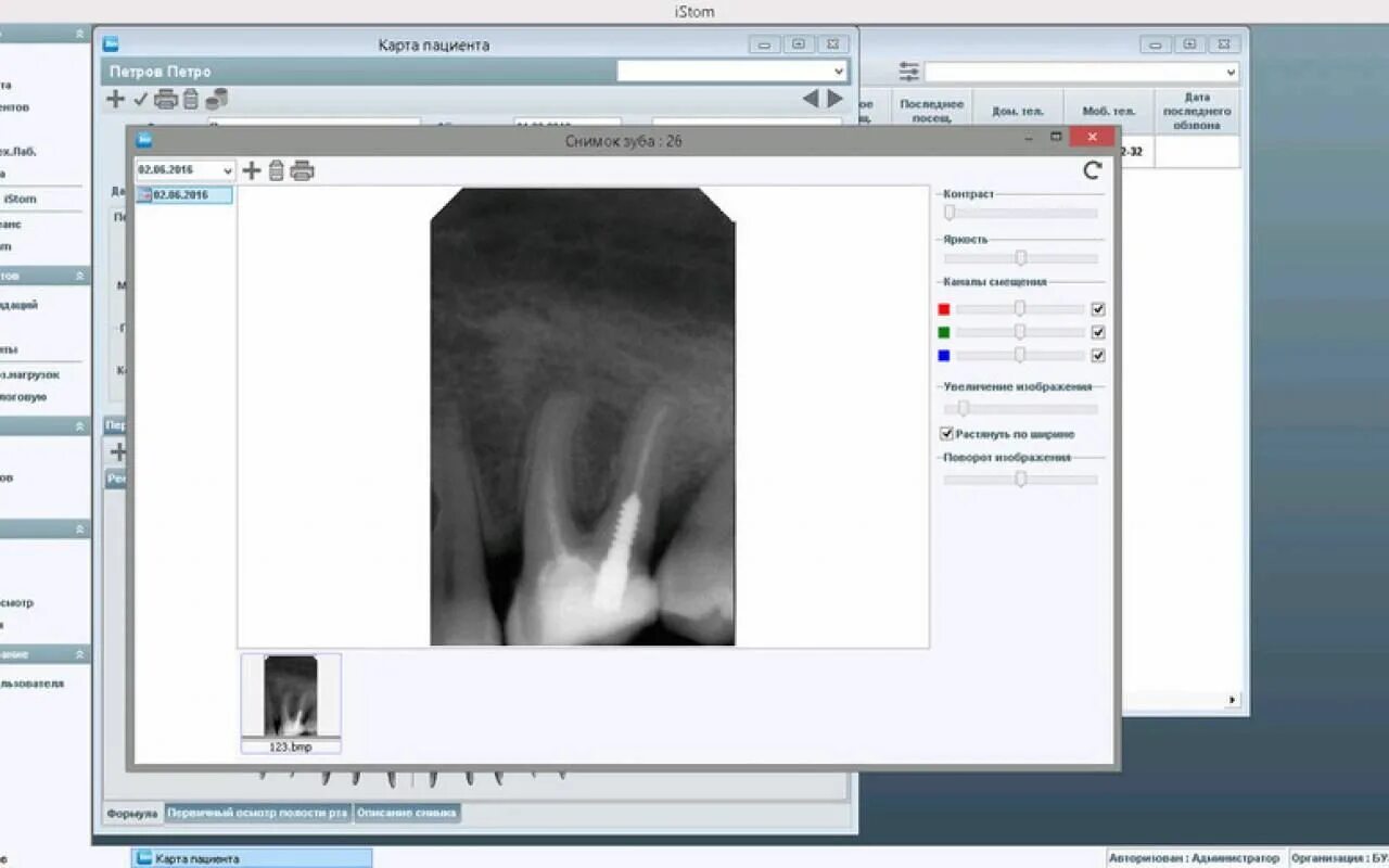 Дента 1 программа. Программы для стоматологических клиник. Программы автоматизации для стоматологии. Istom программа для стоматологии. Программа для снимков в стоматологии.