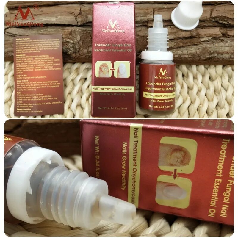 Лечебное масло для ногтей. Масло для лечения ногтей. Масло для лечения ногтей. Лечебное масло для ногтей алькана. Китайское средство от грибка fungal nail treatment.