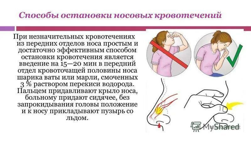 Положение больного при носовом кровотечении