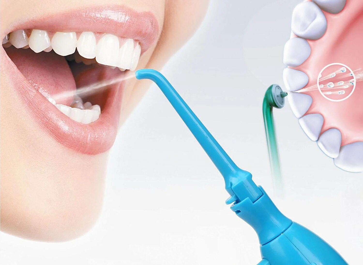 Профгигиена (ультразвук + Air-Flow). Ирригатор для полости рта гигиена рта. Стоматология аир
