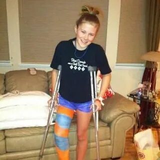 She broke has broken her leg