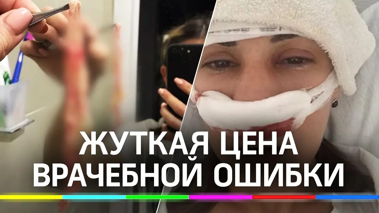 Про коронавирус (720p). Терешенцев александр павлович ефремов 8лет. Врач забыл тампон при операции сериал. Моим пациентам. Разоблачение врачей.