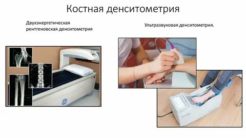 Денситометрия это