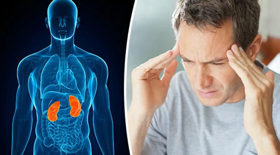 Заболевания почек и головные боли. Ваш ответ неправильный. Ты все неправильно понял. Мемы правильный ответ. Неверно картинка.