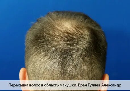 3 темечка