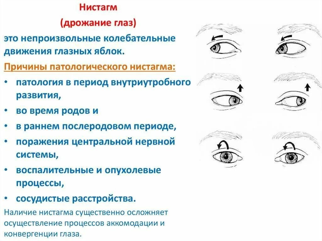 Трясется глаз