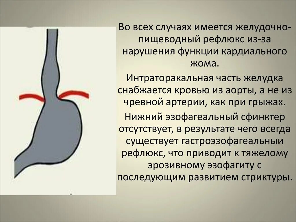 Синдром афазия ландау-клеффнера. Стадии невроза. Кардия и привратник желудка. Кардиальный жом желудка. Нарушения ритма сердца клинические проявления.