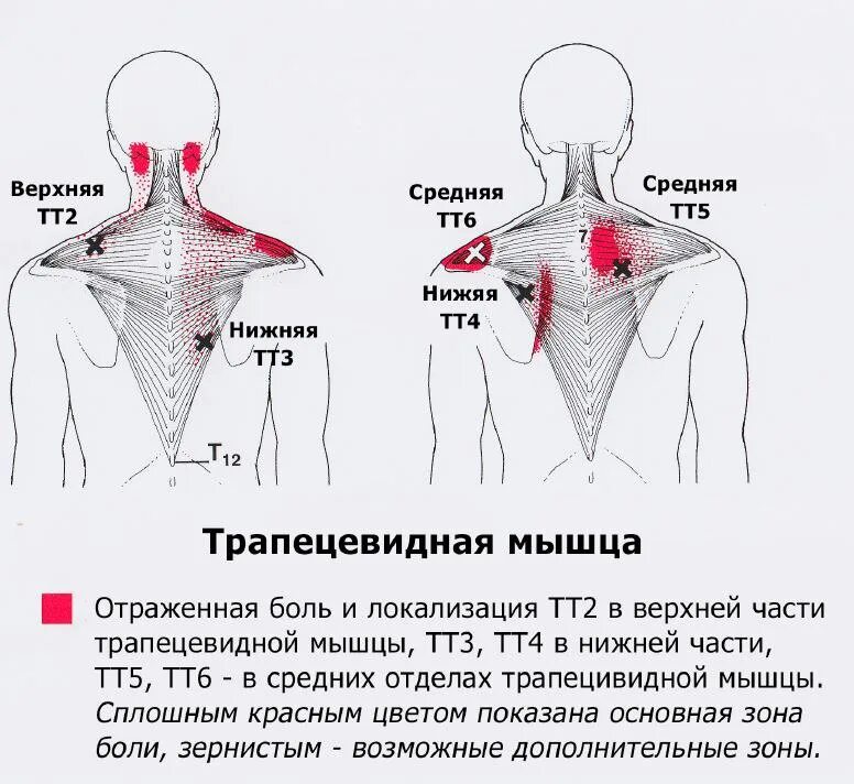 Банки на печень. Хиджама кровопускание схема точки. Хиджама при боли в ногах точки. Хиджама при головных болях точки.