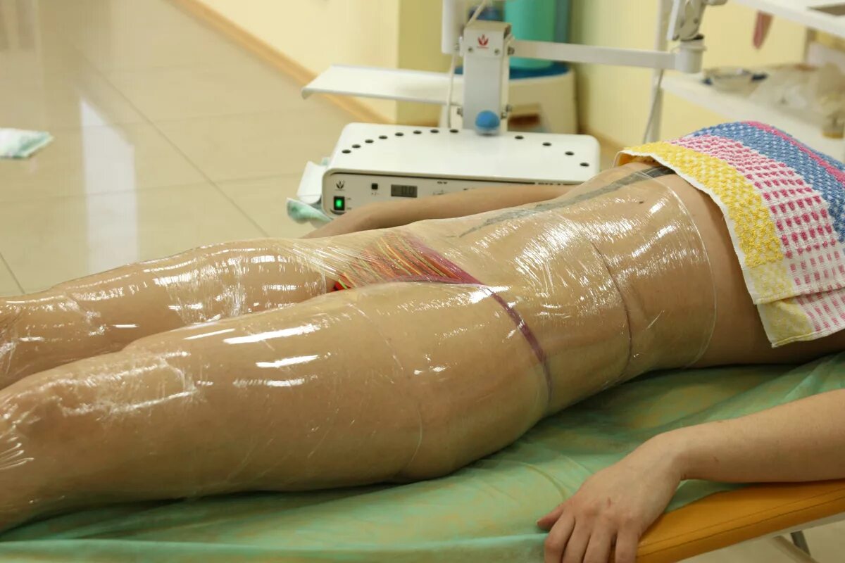 Медовый массаж. Обертывания как часто. Антицеллюлитный массаж с обертыванием. Обёртывание для похудения. Горячее обертывание.