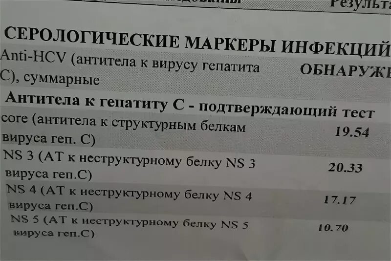 Гепатит с антитела обнаружены что это значит. Core (антитела к структурным белкам. Антитела к гепатиту в. Антитела к вирусу гепатита c. Антитела к вирусу гепатита с суммарные.